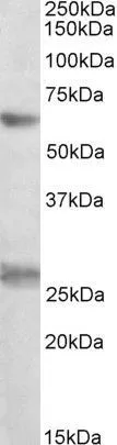 WB analysis of K562 lysate using GTX88019 eIF2B delta antibody, Internal. Dilution : 0.3microg/ml Loading : 35microg protein in RIPA buffer WB analysis of K562 lysate using GTX88019 eIF2B delta antibody, Internal. Dilution : 0.3microg/ml Loading : 35microg protein in RIPA buffer