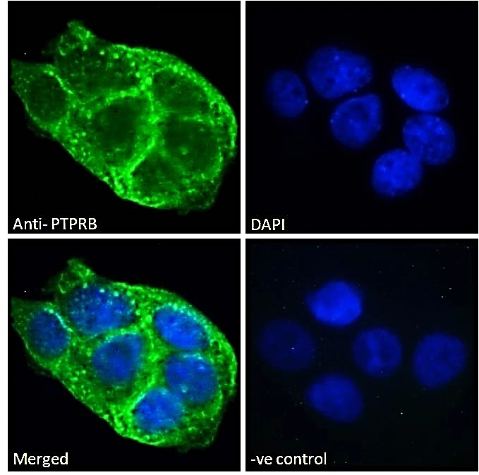 ICC/IF analysis of PFA-fixed A431 cells using GTX88020 PTPRB antibody, Internal. Negative control (-ve) : Unimmunized goat IgG Permeabilization : 0.15% Triton Dilution : 10ug/ml