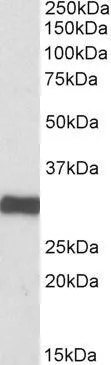 WB analysis of human heart lysate using GTX88023 ETFA antibody, C-term. Dilution : 0.1microg/ml Loading : 35microg protein in RIPA buffer WB analysis of human heart lysate using GTX88023 ETFA antibody, C-term. Dilution : 0.1microg/ml Loading : 35microg protein in RIPA buffer