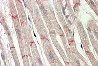 IHC-P analysis of human heart using GTX88029 Desmoplakin (aa 1672 -1684) antibody, Internal. Antigen retrieval : citrate buffer pH 6 Dilution : 3.8microg/ml IHC-P analysis of human heart using GTX88029 Desmoplakin (aa 1672 -1684) antibody, Internal. Antigen retrieval : citrate buffer pH 6 Dilution : 3.8microg/ml