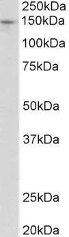 WB analysis of mouse liver lysate using GTX88030 Pex1 antibody, Internal. Dilution : 0.3microg/ml Loading : 35microg protein in RIPA buffer WB analysis of mouse liver lysate using GTX88030 Pex1 antibody, Internal. Dilution : 0.3microg/ml Loading : 35microg protein in RIPA buffer
