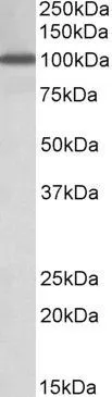 WB analysis of peripheral blood lymphocytes lysate using GTX88032 NUP107 antibody, Internal. Dilution : 1microg/ml Loading : 35microg protein in RIPA buffer WB analysis of peripheral blood lymphocytes lysate using GTX88032 NUP107 antibody, Internal. Dilution : 1microg/ml Loading : 35microg protein in RIPA buffer