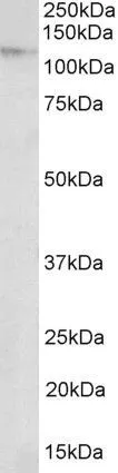 WB analysis of NIH-3T3 nuclear lysate using GTX88032 NUP107 antibody, Internal. Dilution : 2microg/ml Loading : 35microg protein in RIPA buffer