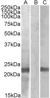 WB analysis of HEK293 overexpressing human Cystatin 8 with C-terminal MYC tag using GTX88034 Cystatin 8 (aa 100-112) antibody, Internal. Lane A : primary antibody Lane B : Mock-transfected HEK293 probed with primary antibody Lane C : Tag antibody Dilution : 1microg/ml Loading : 10microg protein in RIPA buffer WB analysis of HEK293 overexpressing human Cystatin 8 with C-terminal MYC tag using GTX88034 Cystatin 8 (aa 100-112) antibody, Internal. Lane A : primary antibody Lane B : Mock-transfected HEK293 probed with primary antibody Lane C : Tag antibody Dilution : 1microg/ml Loading : 10microg protein in RIPA buffer
