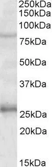 WB analysis of human hippocampus lysate using GTX88035 GPRIN3 antibody, Internal. Dilution : 1microg/ml Loading : 35microg protein in RIPA buffer WB analysis of human hippocampus lysate using GTX88035 GPRIN3 antibody, Internal. Dilution : 1microg/ml Loading : 35microg protein in RIPA buffer