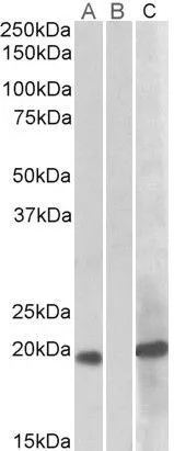 WB analysis of HEK293 overexpressing human HOXA1 with C-terminal MYC tag using GTX88041 HOXA1 antibody, Internal. Lane A : primary antibody Lane B : Mock-transfected HEK293 probed with primary antibody Lane C : Tag antibody Dilution : 1microg/ml Loading : 10microg protein in RIPA buffer WB analysis of HEK293 overexpressing human HOXA1 with C-terminal MYC tag using GTX88041 HOXA1 antibody, Internal. Lane A : primary antibody Lane B : Mock-transfected HEK293 probed with primary antibody Lane C : Tag antibody Dilution : 1microg/ml Loading : 10microg protein in RIPA buffer