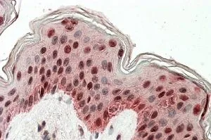 IHC-P analysis of human skin using GTX88042 TIAL1 antibody, Internal. Antigen retrieval : citrate buffer pH 6 Dilution : 3.8microg/ml IHC-P analysis of human skin using GTX88042 TIAL1 antibody, Internal. Antigen retrieval : citrate buffer pH 6 Dilution : 3.8microg/ml