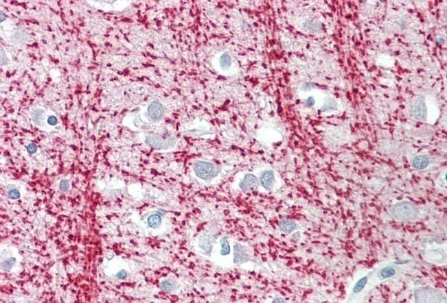 IHC-P analysis of human cortex using GTX88044 TPPP antibody, Internal. Antigen retrieval : citrate buffer pH 6 Dilution : 3.75microg/ml