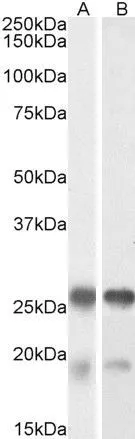 WB analysis of mouse (A) and rat (B) brain lysate using GTX88044 TPPP antibody, Internal. Dilution : 0.001microg/ml Loading : 35microg protein in RIPA buffer