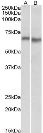 ELISA analysis of AMPK alpha 2 protein using GTX88046 AMPK alpha 2 antibody,Internal. Capture : GTX113251 (2.5ug/ml) Detection : GTX88046 (1.5ug/ml)