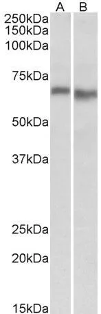 WB analysis of mouse (A) and rat (B) heart lysate using GTX88046 AMPK alpha 2 antibody, Internal. Dilution : 0.3microg/ml Loading : 35microg protein in RIPA buffer