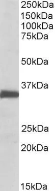 WB analysis of rat lung lysate using GTX88049 Ephrin B2 antibody, Internal. Dilution : 0.1microg/ml Loading : 35microg protein in RIPA buffer