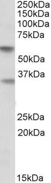 WB analysis of human placenta lysate using GTX88051 SIGLEC6 antibody, Internal. Dilution : 0.5microg/ml Loading : 35microg protein in RIPA buffer WB analysis of human placenta lysate using GTX88051 SIGLEC6 antibody, Internal. Dilution : 0.5microg/ml Loading : 35microg protein in RIPA buffer