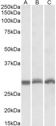 WB analysis of NIH-3T3 (A), mouse spleen (B), rat spleen (C)) lysates using GTX88053 PSMA4 antibody, Internal. Dilution : 0.3microg/ml Loading : 35microg protein in RIPA buffer WB analysis of NIH-3T3 (A), mouse spleen (B), rat spleen (C)) lysates using GTX88053 PSMA4 antibody, Internal. Dilution : 0.3microg/ml Loading : 35microg protein in RIPA buffer
