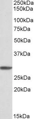 WB analysis of K562 cell lysate using GTX88053 PSMA4 antibody, Internal. Dilution : 1microg/ml Loading : 35microg protein in RIPA buffer