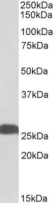 WB analysis of human hippocampus lysate using GTX88056 PGP9.5 antibody, Internal. Dilution : 0.01microg/ml Loading : 35microg protein in RIPA buffer WB analysis of human hippocampus lysate using GTX88056 PGP9.5 antibody, Internal. Dilution : 0.01microg/ml Loading : 35microg protein in RIPA buffer