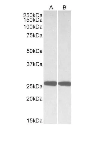 WB analysis of mouse (A) and rat (B) brain lysates using GTX88056 PGP9.5 antibody, Internal. Dilution : 0.01microg/ml Loading : 35microg protein in RIPA buffer