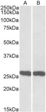 WB analysis of mouse (A) and rat (B) brain lysate using GTX88060 PGP9.5 antibody, C-term. Dilution : 0.01microg/ml Loading : 35microg protein in RIPA buffer WB analysis of mouse (A) and rat (B) brain lysate using GTX88060 PGP9.5 antibody, C-term. Dilution : 0.01microg/ml Loading : 35microg protein in RIPA buffer