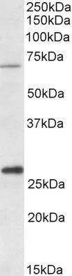 WB analysis of human liver lysate using GTX88067 CPT2 (aa141-154) antibody, Internal. Dilution : 1microg/ml Loading : 35microg protein in RIPA buffer WB analysis of human liver lysate using GTX88067 CPT2 (aa141-154) antibody, Internal. Dilution : 1microg/ml Loading : 35microg protein in RIPA buffer