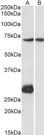 WB analysis of mouse heart (A) and liver (B) lysate using GTX88067 CPT2 (aa141-154) antibody, Internal. Dilution : 1microg/ml Loading : 35microg protein in RIPA buffer