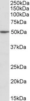 WB analysis of Jurkat lysate using GTX88071 MON1A antibody, Internal. Dilution : 2microg/ml Loading : 35microg protein in RIPA buffer WB analysis of Jurkat lysate using GTX88071 MON1A antibody, Internal. Dilution : 2microg/ml Loading : 35microg protein in RIPA buffer