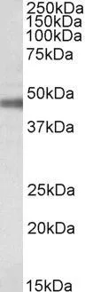 WB analysis of rat retina lysate using GTX88074 Sodium/Potassium ATPase beta 1 antibody, Internal. Dilution : 0.1microg/ml Loading : 35microg protein in RIPA buffer WB analysis of rat retina lysate using GTX88074 Sodium/Potassium ATPase beta 1 antibody, Internal. Dilution : 0.1microg/ml Loading : 35microg protein in RIPA buffer