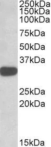 IHC-P analysis of human breast using GTX88075 TIPRL antibody,C-term. Antigen retrieval : citrate buffer pH 6 Dilution : 3.75ug/ml