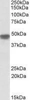 WB analysis of human heart lysate using GTX88084 NDUFS2 antibody, Internal. Dilution : 0.1microg/ml Loading : 35microg protein in RIPA buffer WB analysis of human heart lysate using GTX88084 NDUFS2 antibody, Internal. Dilution : 0.1microg/ml Loading : 35microg protein in RIPA buffer