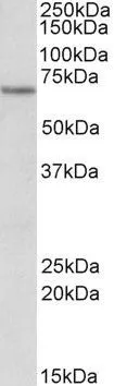 WB analysis of human kidney lysate using GTX88086 ETFDH antibody, Internal. Dilution : 1microg/ml Loading : 35microg protein in RIPA buffer WB analysis of human kidney lysate using GTX88086 ETFDH antibody, Internal. Dilution : 1microg/ml Loading : 35microg protein in RIPA buffer
