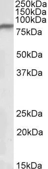 WB analysis of human heart lysate using GTX88087 NDUFS1 antibody, Internal. Dilution : 0.3microg/ml Loading : 35microg protein in RIPA buffer WB analysis of human heart lysate using GTX88087 NDUFS1 antibody, Internal. Dilution : 0.3microg/ml Loading : 35microg protein in RIPA buffer