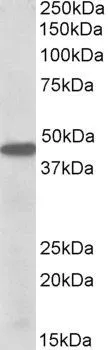WB analysis of K562 lysate using GTX88088 PBX1 antibody, Internal. Dilution : 0.5microg/ml Loading : 35microg protein in RIPA buffer WB analysis of K562 lysate using GTX88088 PBX1 antibody, Internal. Dilution : 0.5microg/ml Loading : 35microg protein in RIPA buffer