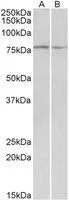 WB analysis of mouse and rat skeletal muscle lysate using GTX88089 DAG1 antibody, Internal. Dilution : 0.1microg/ml Loading : 35microg protein in RIPA buffer WB analysis of mouse and rat skeletal muscle lysate using GTX88089 DAG1 antibody, Internal. Dilution : 0.1microg/ml Loading : 35microg protein in RIPA buffer