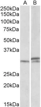 WB analysis of mouse and rat spinal cord lysates using GTX88093 HOXA9 antibody,Internal. Dilution : 1ug/ml Loading : 35ug protein in RIPA buffer