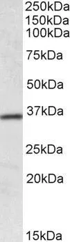 WB analysis of human colon lysate using GTX88095 HOXA4 antibody,Internal. Dilution : 0.1ug/ml Loading : 35ug protein in RIPA buffer