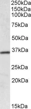 WB analysis of human colon lysate using GTX88095 HOXA4 antibody, Internal. Dilution : 0.1microg/ml Loading : 35microg protein in RIPA buffer WB analysis of human colon lysate using GTX88095 HOXA4 antibody, Internal. Dilution : 0.1microg/ml Loading : 35microg protein in RIPA buffer