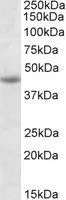 WB analysis of Jurkat lysate using GTX88107 GNAS antibody, Internal. Dilution : 1microg/ml Loading : 35microg protein in RIPA buffer