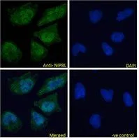ICC/IF analysis of PFA fixed HeLa cells using GTX88110 NIPBL antibody, Internal. Green : Primary antibody Blue : DAPI Negative control : Unimmunized goat IgG Permeabilization : 0.15% Triton Dilution : 10microg/ml