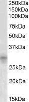 WB analysis of mouse kidney lysate using GTX88132 IGFBP7 antibody, Internal. Dilution : 1microg/ml Loading : 35microg protein in RIPA buffer WB analysis of mouse kidney lysate using GTX88132 IGFBP7 antibody, Internal. Dilution : 1microg/ml Loading : 35microg protein in RIPA buffer