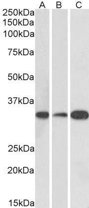 WB analysis of human (A), mouse (B) and rat (C) brain lysate using GTX88134 EB3 (aa151-164) antibody, Internal. Dilution : 0.1microg/ml Loading : 35microg protein in RIPA buffer WB analysis of human (A), mouse (B) and rat (C) brain lysate using GTX88134 EB3 (aa151-164) antibody, Internal. Dilution : 0.1microg/ml Loading : 35microg protein in RIPA buffer