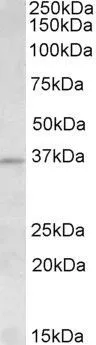 WB analysis of human testis lysate using GTX88135 Aurora C antibody, N-term. Dilution : 1.5microg/ml Loading : 35microg protein in RIPA buffer WB analysis of human testis lysate using GTX88135 Aurora C antibody, N-term. Dilution : 1.5microg/ml Loading : 35microg protein in RIPA buffer