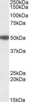 WB analysis of human pancreas lysate using GTX88138 MON1A (aa478-489) antibody, Internal. Dilution : 1microg/ml Loading : 35microg protein in RIPA buffer WB analysis of human pancreas lysate using GTX88138 MON1A (aa478-489) antibody, Internal. Dilution : 1microg/ml Loading : 35microg protein in RIPA buffer
