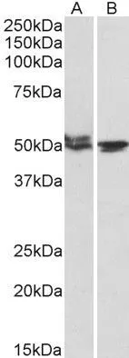 WB analysis of mouse (A) and rat (B) testis lysates using GTX88138 MON1A (aa478-489) antibody, Internal. Dilution : 1microg/ml Loading : 35microg protein in RIPA buffer