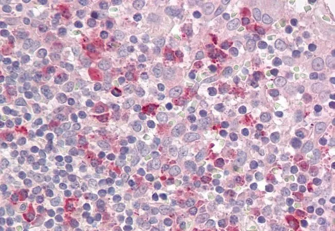 IHC-P analysis of human tonsil using GTX88141 LAIR1 antibody, Internal. Antigen retrieval : citrate buffer pH 6 Dilution : 3.75microg/ml IHC-P analysis of human tonsil using GTX88141 LAIR1 antibody, Internal. Antigen retrieval : citrate buffer pH 6 Dilution : 3.75microg/ml