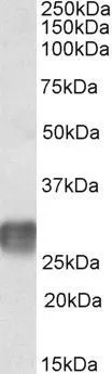 WB analysis of human lymph node lysate using GTX88141 LAIR1 antibody, Internal. Dilution : 2microg/ml Loading : 35microg protein in RIPA buffer