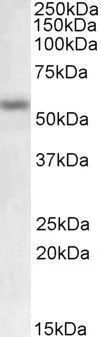 WB analysis of human breast cancer lysate using GTX88142 MMP12 antibody, Internal. Dilution : 0.5microg/ml Loading : 35microg protein in RIPA buffer WB analysis of human breast cancer lysate using GTX88142 MMP12 antibody, Internal. Dilution : 0.5microg/ml Loading : 35microg protein in RIPA buffer
