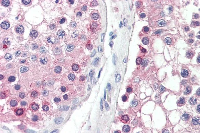 IHC-P analysis of human testis using GTX88143 DYDC1 (aa142-154) antibody, Internal. Antigen retrieval : citrate buffer pH 6 Dilution : 5microg/ml IHC-P analysis of human testis using GTX88143 DYDC1 (aa142-154) antibody, Internal. Antigen retrieval : citrate buffer pH 6 Dilution : 5microg/ml