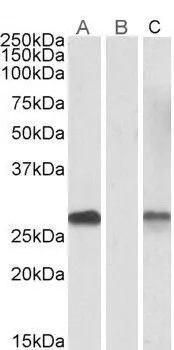 WB analysis of HEK293 overexpressing human DYDC1 lysate with C-terminal MYC tag using GTX88143 DYDC1 (aa142-154) antibody, Internal. Lane A : primary antibody Lane B : Mock-transfected HEK293 probed with primary antibody Lane C : Tag antibody Dilution : 1microg/ml Loading : 10microg protein in RIPA buffer