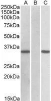 WB analysis of HEK293 overexpressing human CRISP2 with C-terminal MYC tag using GTX88144 CRISP2 (aa77-89) antibody, Internal. Lane A : primary antibody Lane B : Mock-transfected HEK293 probed with primary antibody Lane C : Tag antibody Dilution : 0.11microg/ml Loading : 10microg protein in RIPA buffer WB analysis of HEK293 overexpressing human CRISP2 with C-terminal MYC tag using GTX88144 CRISP2 (aa77-89) antibody, Internal. Lane A : primary antibody Lane B : Mock-transfected HEK293 probed with primary antibody Lane C : Tag antibody Dilution : 0.11microg/ml Loading : 10microg protein in RIPA buffer