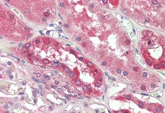 IHC-P analysis of human kidney using GTX88149 PDE1A antibody, C-term. Antigen retrieval : citrate buffer pH 6 Dilution : 3.75microg/ml IHC-P analysis of human kidney using GTX88149 PDE1A antibody, C-term. Antigen retrieval : citrate buffer pH 6 Dilution : 3.75microg/ml