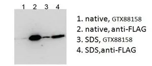 IP analysis of HEK293 overexpressing human BICC1 with N-terminal FLAG in the presence(lane 3 and 4) or absence(lane 1 and 2) of SDS using GTX88158 BICC1 (aa223-234) antibody, Internal(lane 1 and 3) and FLAG antibody(lane 2 and 4). IP analysis of HEK293 overexpressing human BICC1 with N-terminal FLAG in the presence(lane 3 and 4) or absence(lane 1 and 2) of SDS using GTX88158 BICC1 (aa223-234) antibody, Internal(lane 1 and 3) and FLAG antibody(lane 2 and 4).